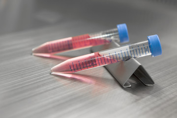 Test-tubes with blood sample in bio lab
