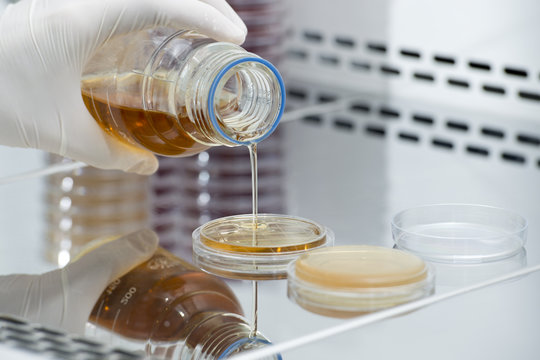 Preparación cultivo bacterias en placas rodac