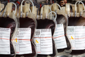 Blood donation - 49312453