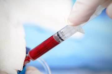 Blood for analysis in the laboratory