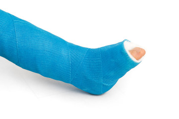 Bandaging of the broken leg with elastic bandage
