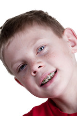 Boy with braces