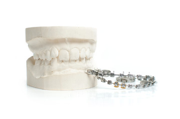 Orthodontics  mould and metal retainer