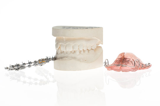 Orthodontics  mould and metal and plastic retainer