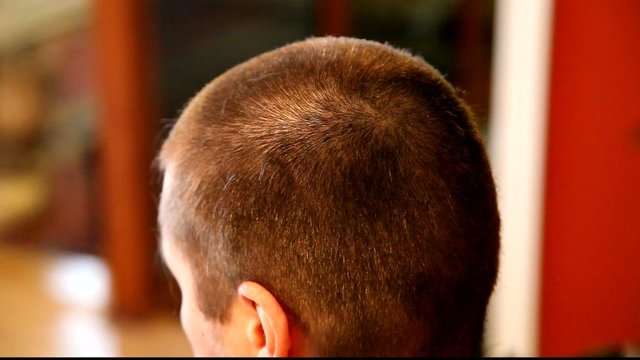 T&ecirc;te ras&eacute;e