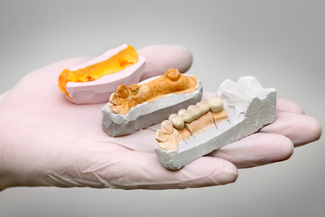 Dentist hold artificial tooth, plaster and wax models