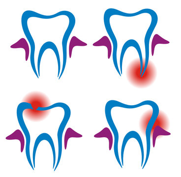 Toothache