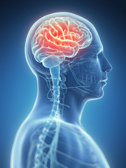 3d rendered illustration - headache