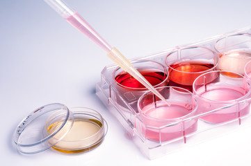 medical laboratory, cells with human blood.
