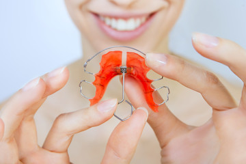 smiling girl with retainer on teeth - obrazy, fototapety, plakaty