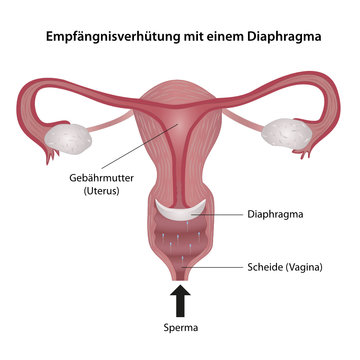 Empf&auml;ngnisverh&uuml;tung mit Diaphragma