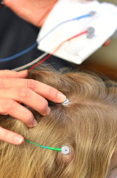 Elektroden Für Neurofeedback auf Kinderkopf