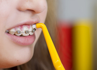 Dental visit