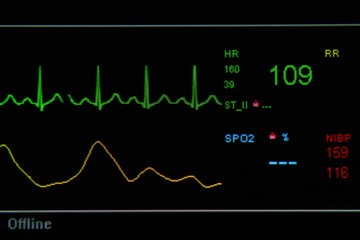 EKG monitor in ICU unit