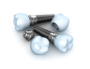 Set of dental implants