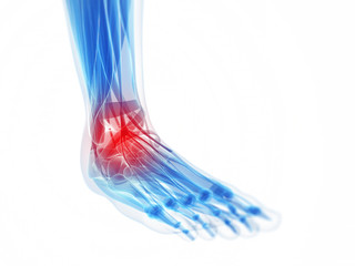 3d rendered illustration of a painful foot