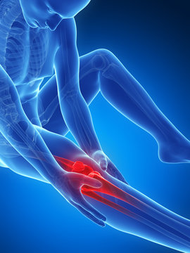 3d rendered illustration of pain in the knee