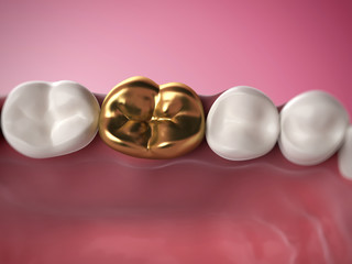 3d rendered illustration of a golden tooth