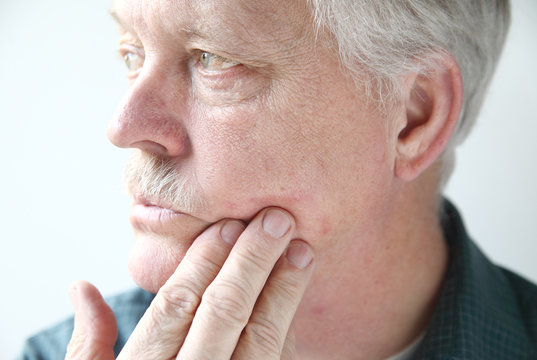 Older Man With A Red, Itchy Rash On His Cheek