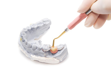 Dental prosthesis on gypsum model plaster with dental tool