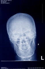 medical x-ray film