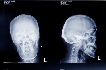 medical x-ray film