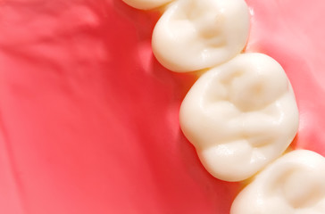 Fototapeta na wymiar Dental model
