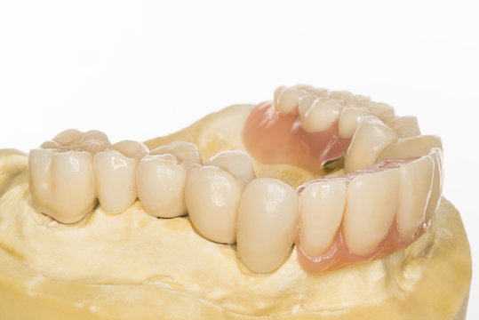 Bilder Teleskopprothese: Drawing a Window to Imagination