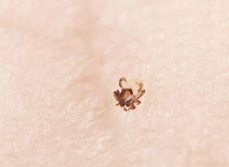 Tick larva feeding on human, extreme close-up