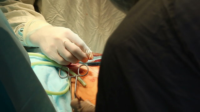Laparoscopic surgery of the abdomen 1