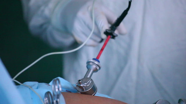 Laparoscopic surgery of the abdomen 8