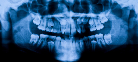 x-ray panoramic dental orthodontic medical background