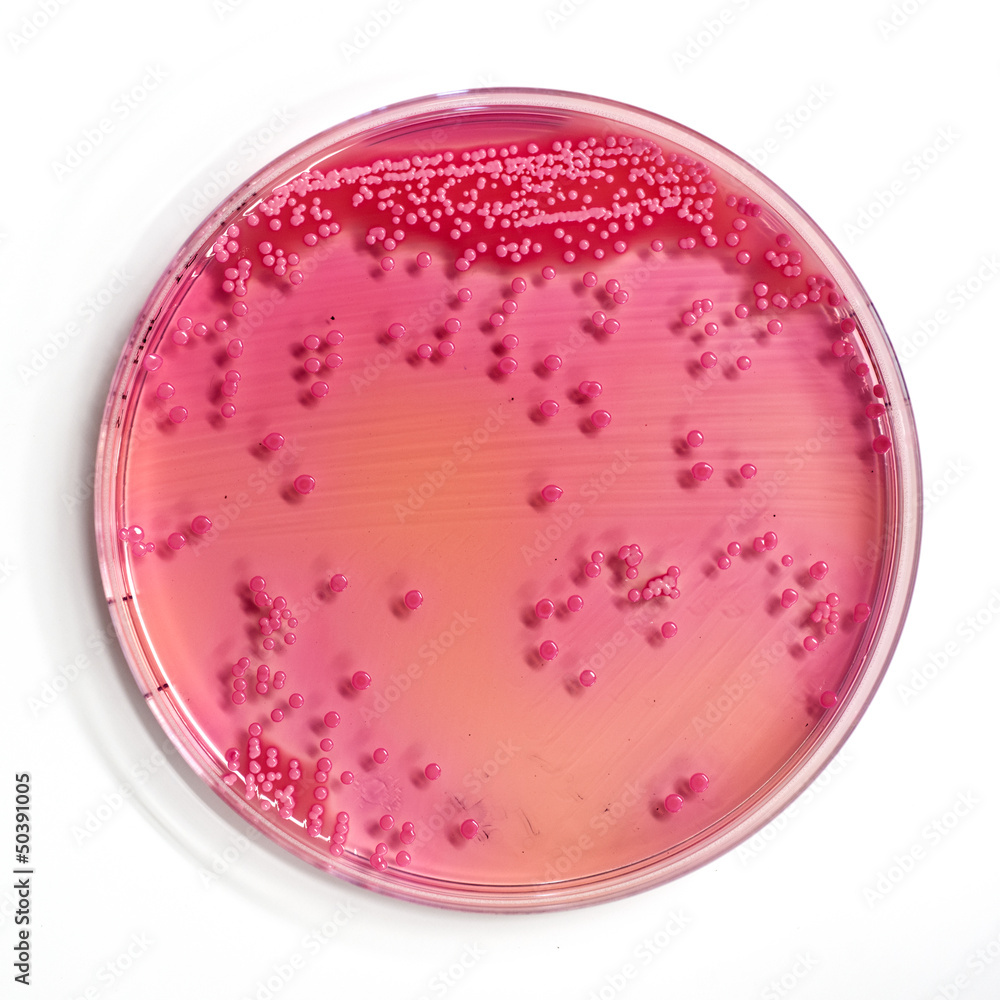 Wall mural agar plate with microorganisms in an hospital laboratory