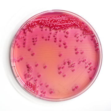 agar plate with microorganisms in an hospital laboratory