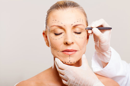 middle aged woman with correction lines