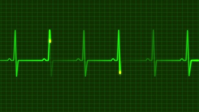 electrocardiograms