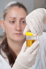 Woman examine urine container