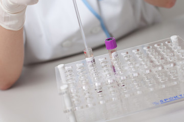 Woman doctor doing erythrocyte sedimentation rate test