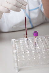 Woman doctor doing erythrocyte sedimentation rate test