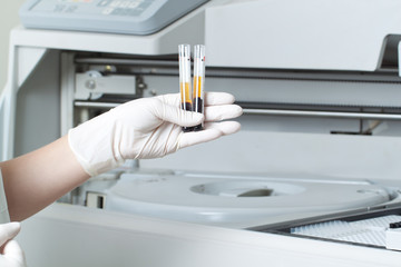 Woman loading samples in biochemical analyzer