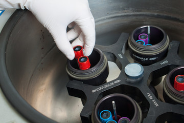 Hands in glove loading centrifuge