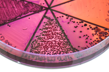 Bacteria on petri dish