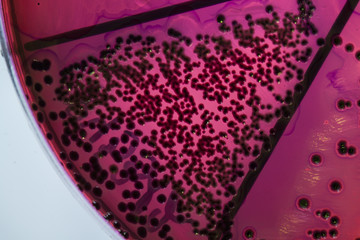 Bacteria on petri dish