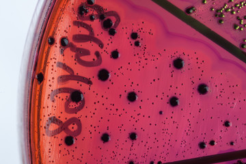 Bacteria on petri dish