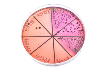 Bacteria on petri dish