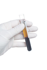 Hand in glove with blood tube