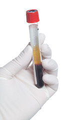 Hand in glove with blood tube