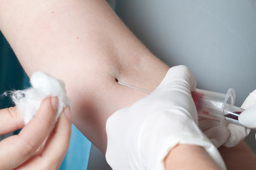 Drawing blood procedure