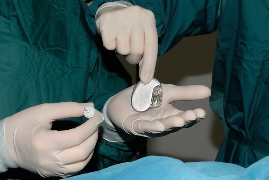Herzschrittmacher Implantation