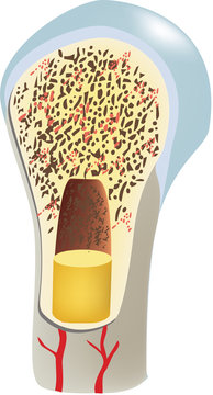 osteoporosi